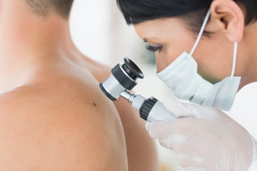 ¿Lunares hinchados? ¡La inflamación o escozor te indican esto!